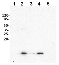 UBQ11 | Ubiquitin (affinity purified) in the group Antibodies Plant/Algal  / Protein Modifications / Autophagy-related and Ubiquitin-like Proteins at Agrisera AB (Antibodies for research) (AS08 307A)
